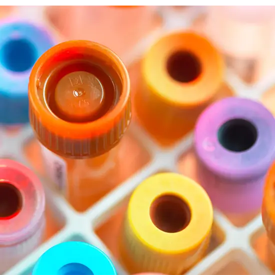 immunofixation blood test